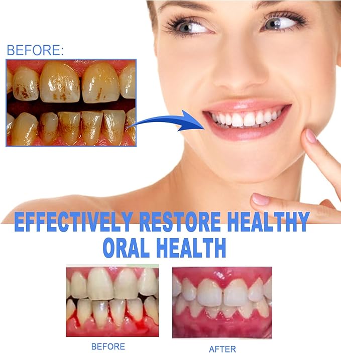 Mendall™ Gum Repair Gel
