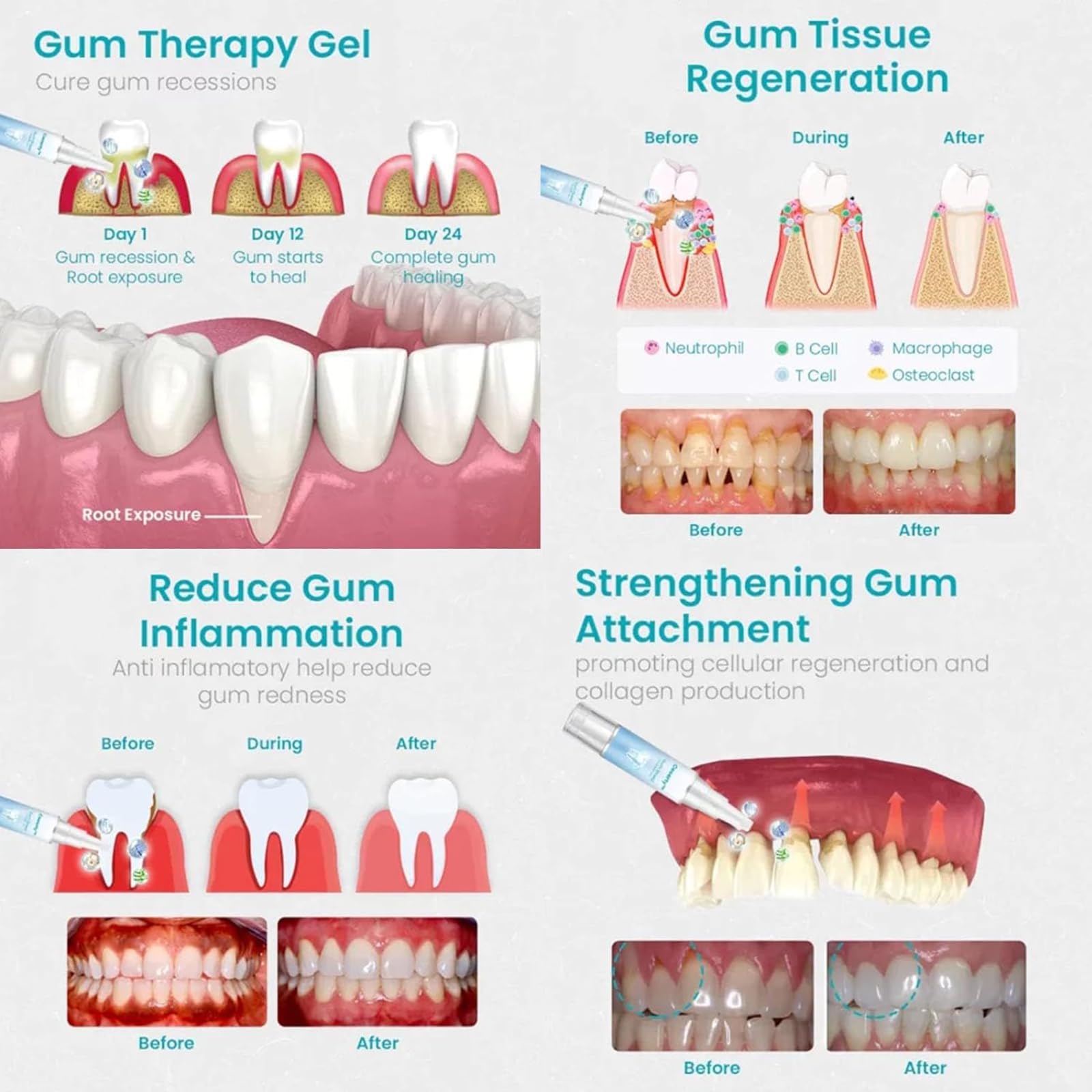 Mendall™ Gum Repair Gel
